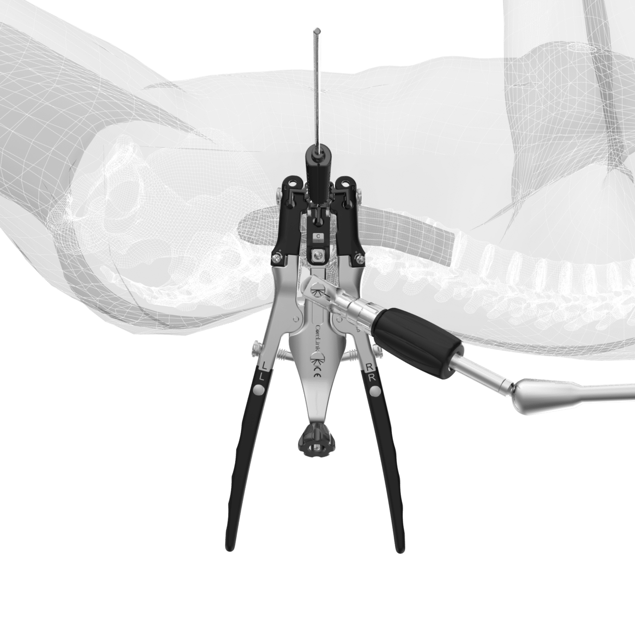 Lateral Access System And Retractor Corelink Surgical 